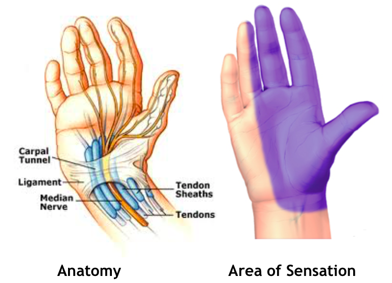Carpal Tunnel Syndrome – Peninsula Hand Therapy